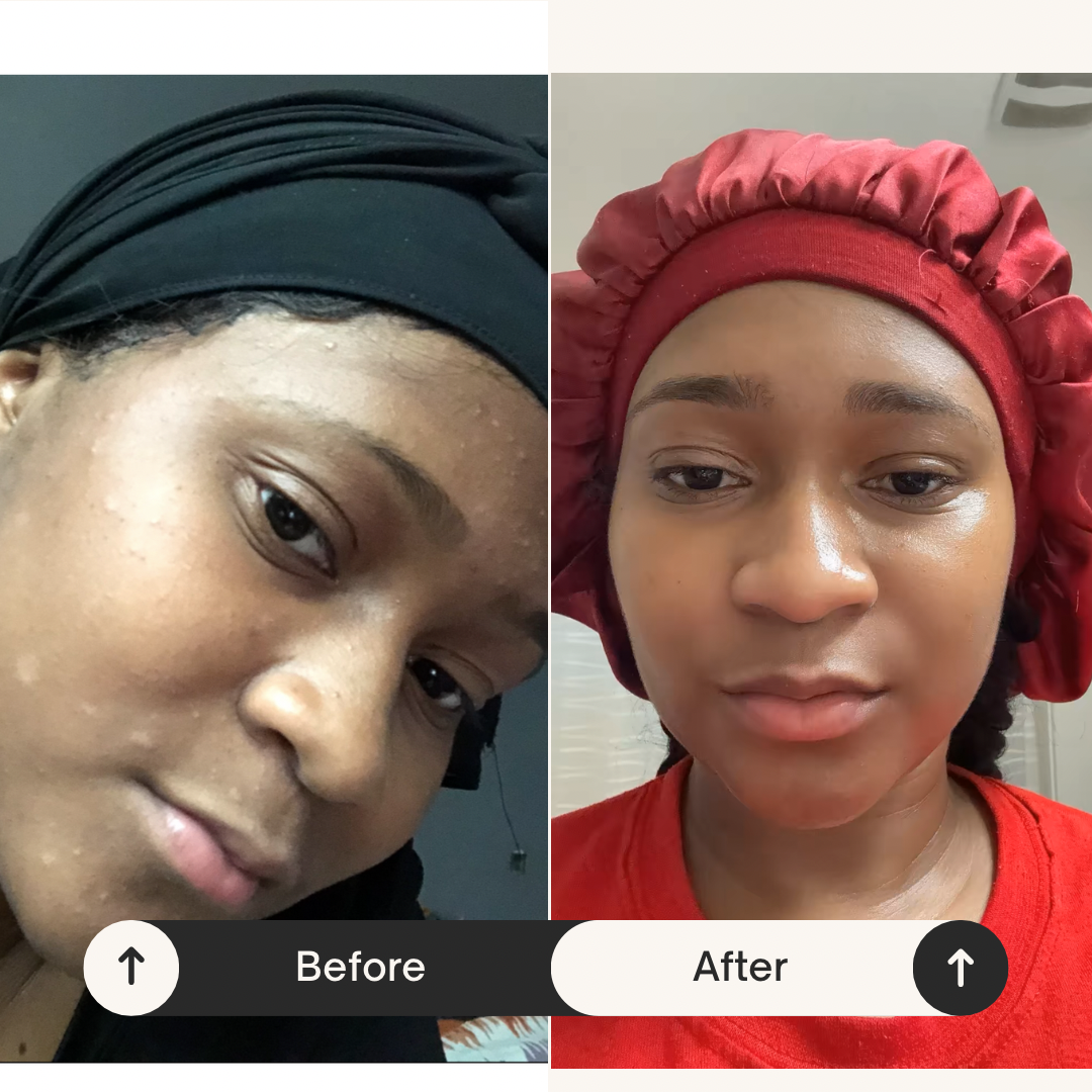 Rosehip Anti-aging Face Oil